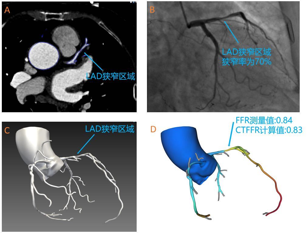 20200902159901323115.png image.png